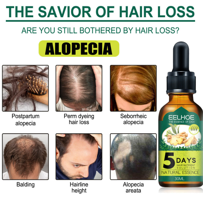 Eelhoe Ginger Hair Essential Oil. Eelhoe Ginger Hair Essential Oil