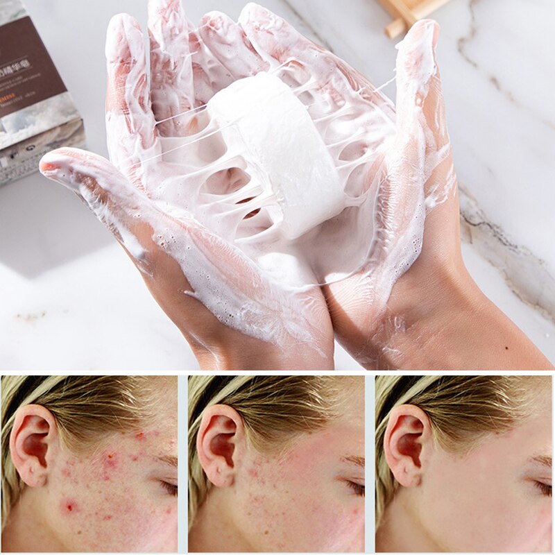 Goat's Milk Silk Foam Soap For Cleansing And Drawing And Anti-Mite Soap