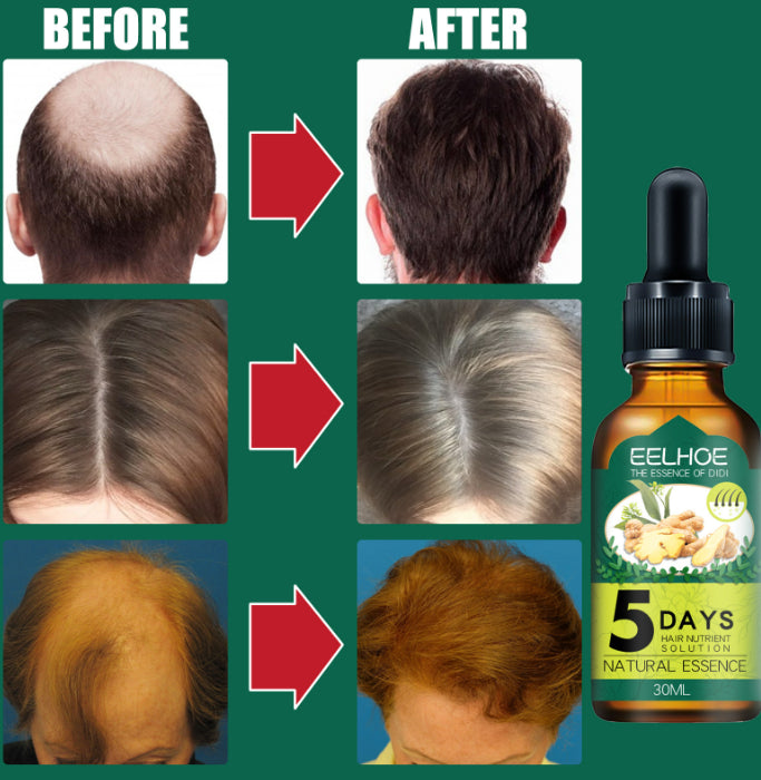 Eelhoe Ginger Hair Essential Oil. Eelhoe Ginger Hair Essential Oil