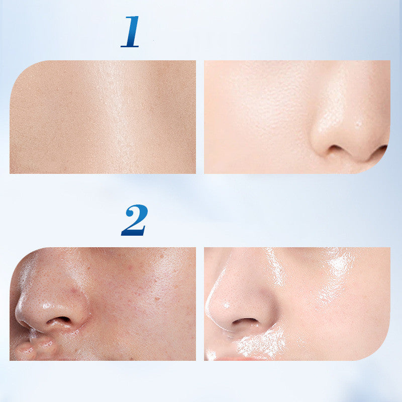 Whitening And Freckle Removing Hydrating And Moisturizing