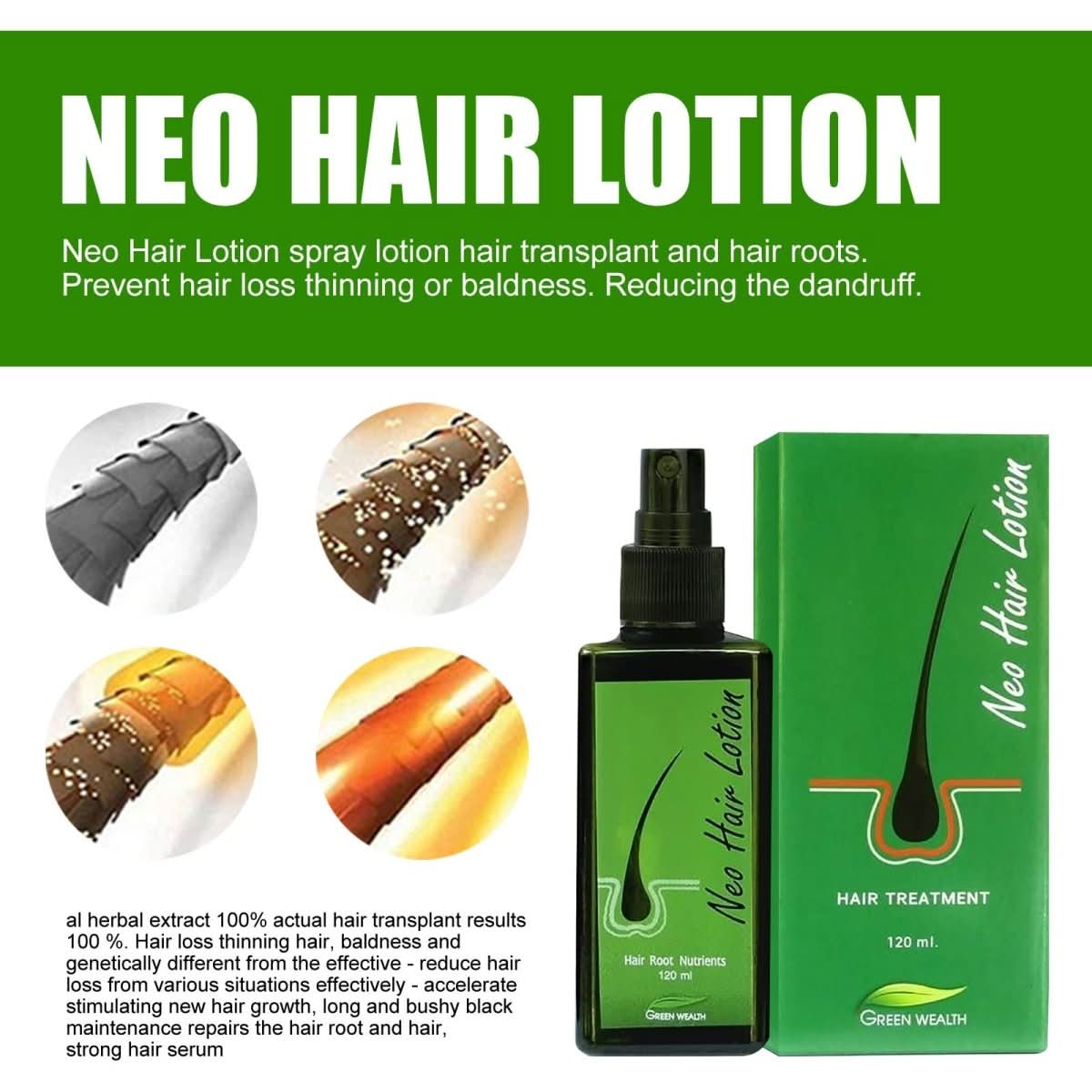 Hair Care Growth Lotion Spray - Eshtree
