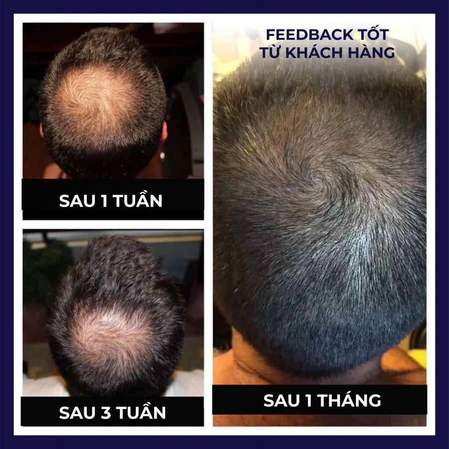 FEG Hair Growth SprayRegrowth