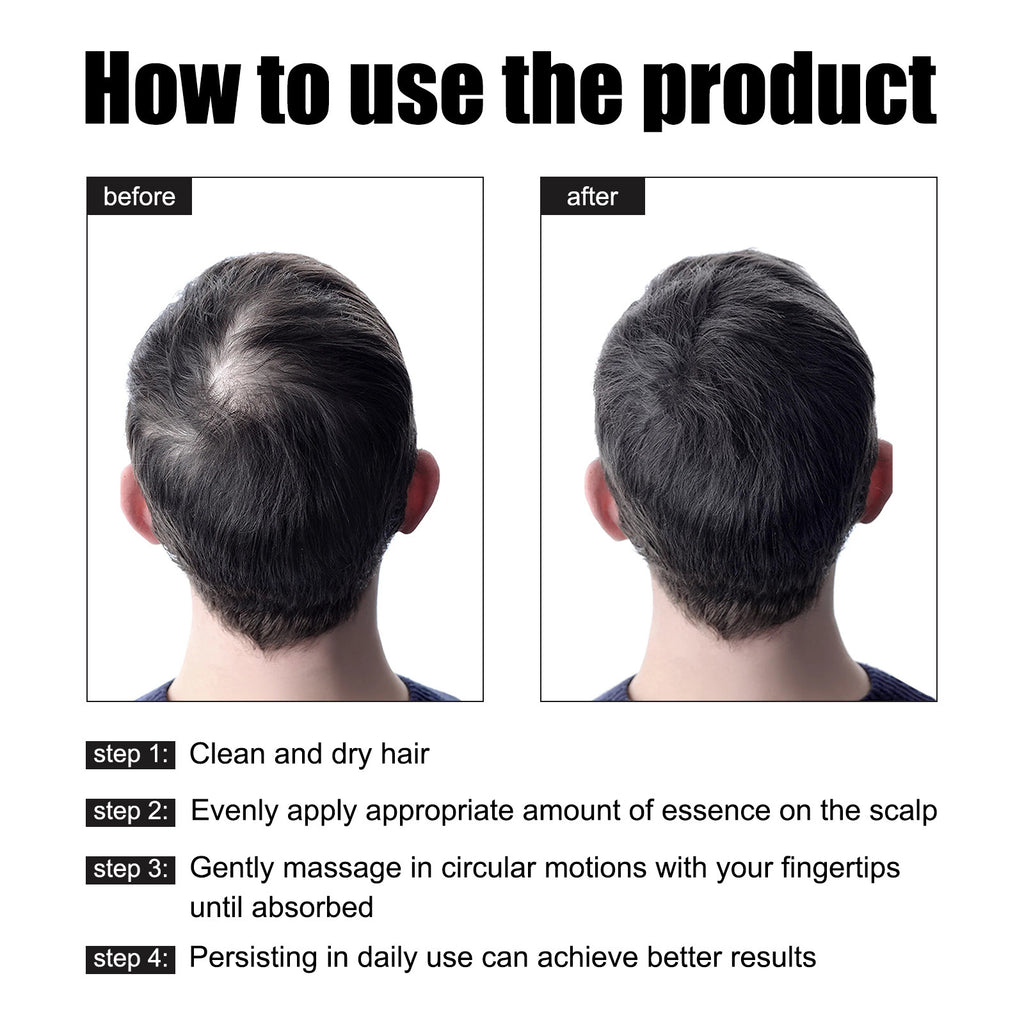 خلاصة إيست مون لتكثيف شعر الرجال - تغذية قوية