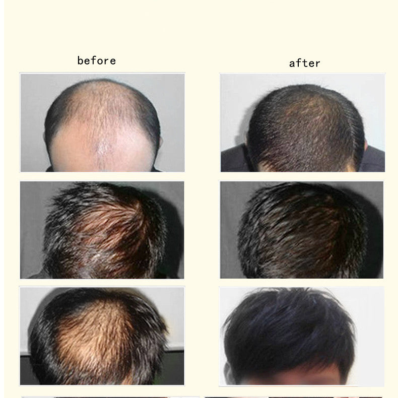 زنجبيل مضاد لتساقط الشعر، للعناية بالشعر، 30 مل