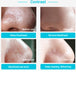 Blackhead nasal membrane with 60 sheets of blackhead tearing powerful to acne T area care