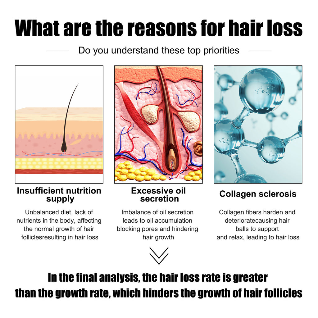 خلاصة إيست مون لتكثيف شعر الرجال - تغذية قوية