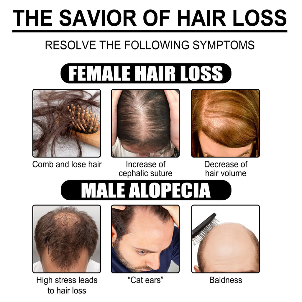 زيت الزنجبيل الأساسي لإصلاح بصيلات الشعر وتنعيمها وترطيبها وتغذيتها