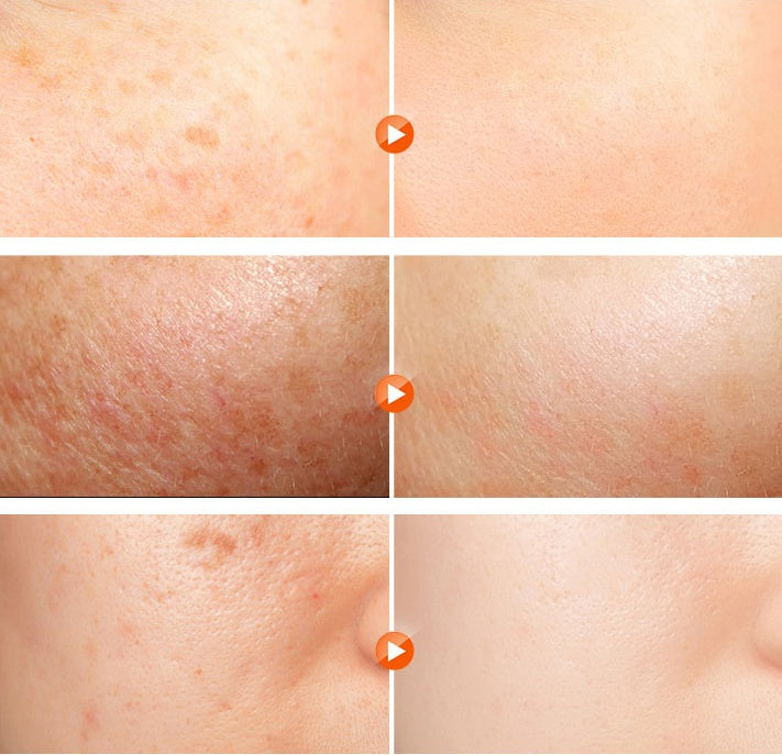 R·RASHEL Whitening Night Cream