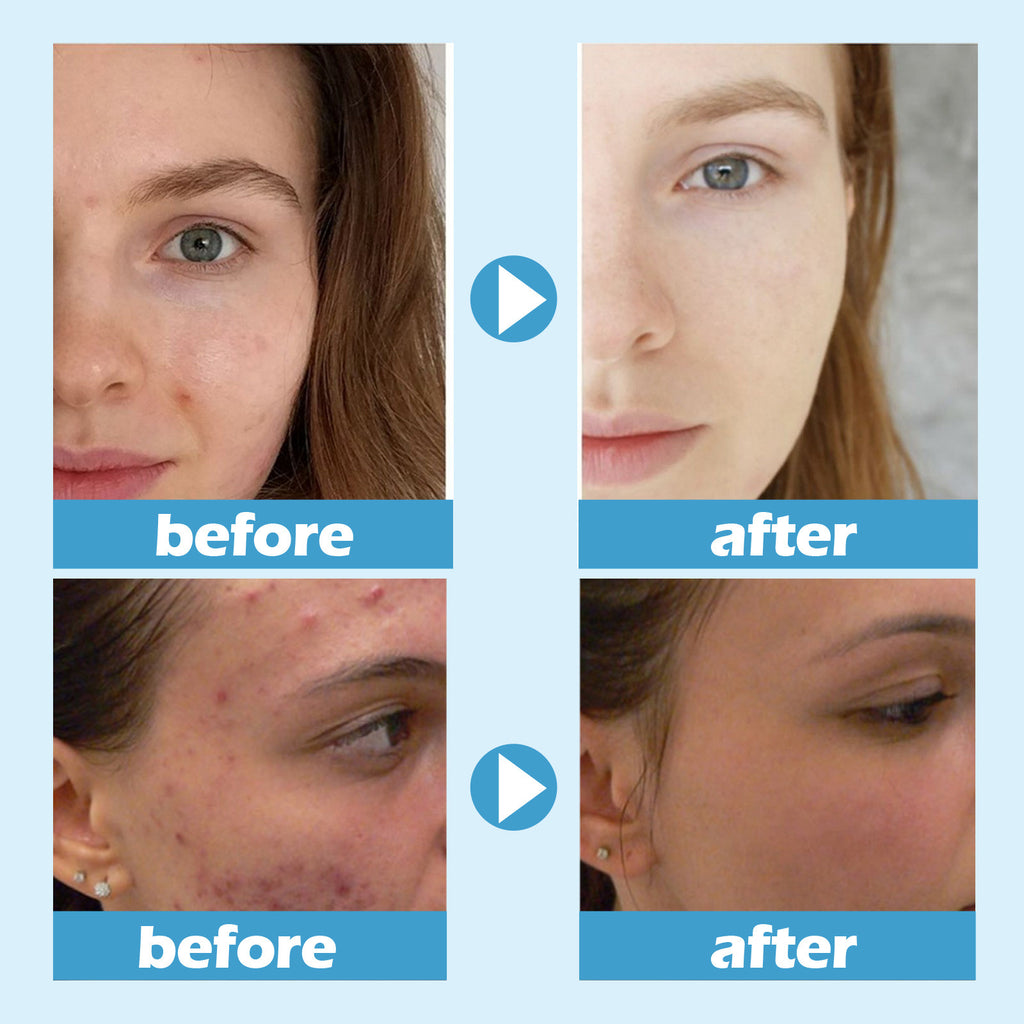 Brightening Sleep Mask Deep Cleansing Pores