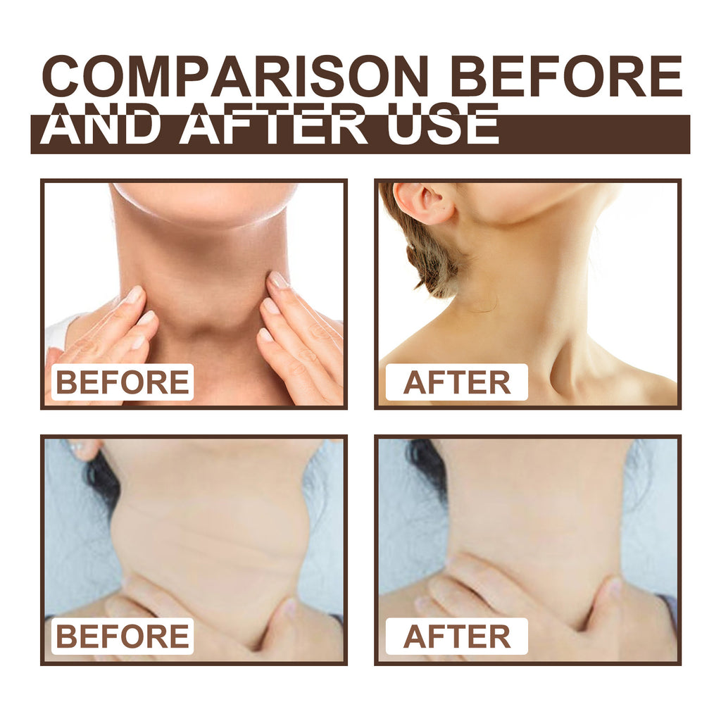 Lymph Repair Cream Relieves Body Health Care