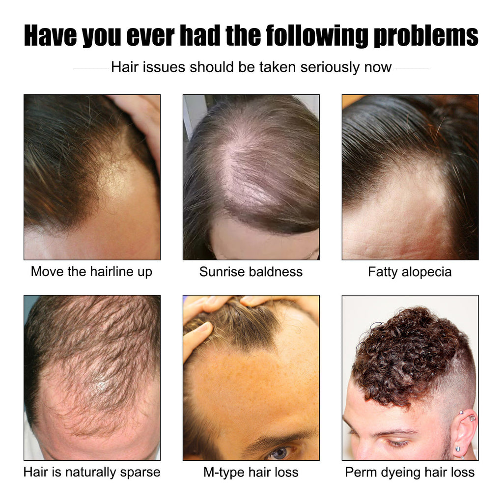 خلاصة إيست مون لتكثيف شعر الرجال - تغذية قوية