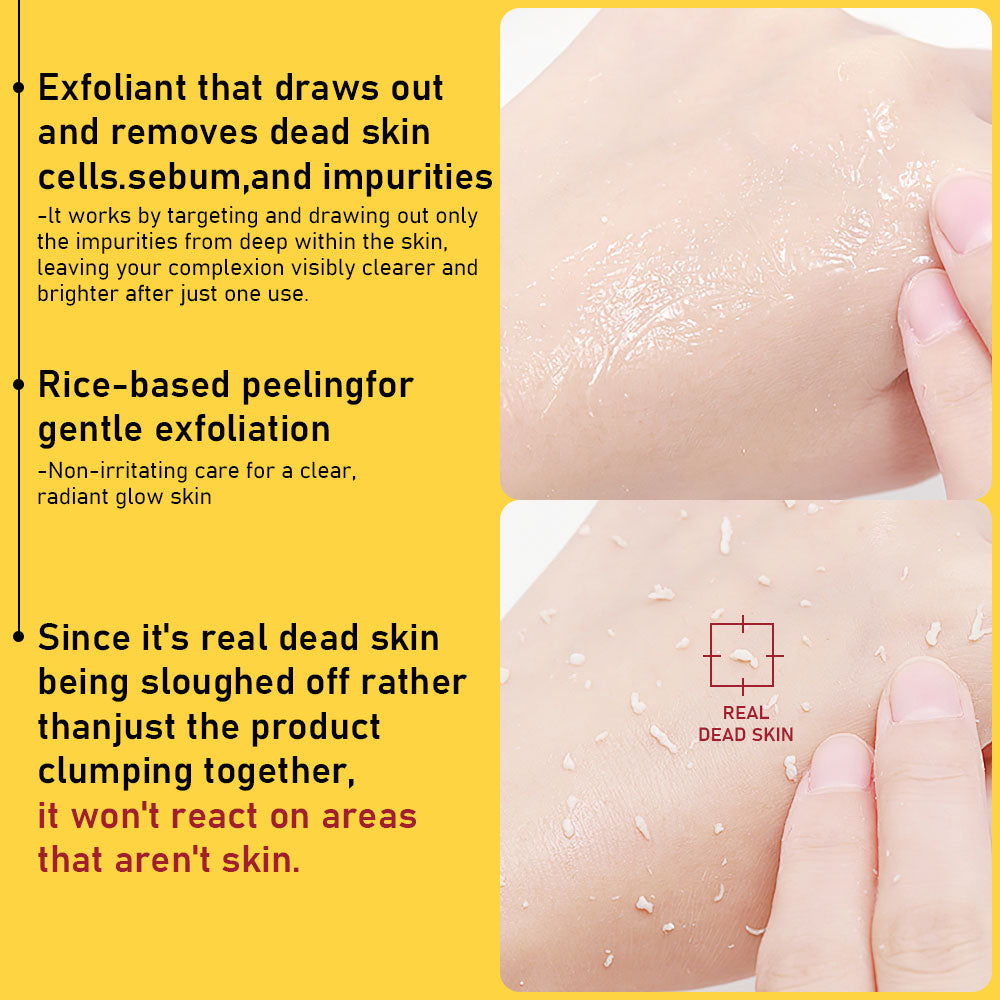 محلول تقشير لطيف من فوفاي، إنزيم البابايا، أحماض ألفا هيدروكسي، أحماض بيتا هيدروكسي