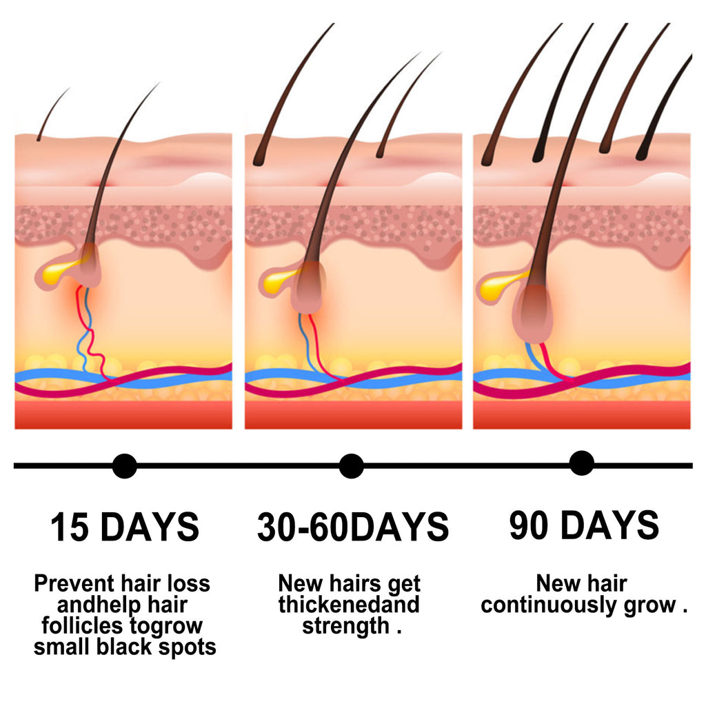 زيت الزنجبيل الأساسي لإصلاح بصيلات الشعر وتنعيمها وترطيبها وتغذيتها
