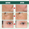 Intensive Anti-wrinkle Fade Fine Lines And Dark Circles Adjust Skin Tone Tighten And Moisturize Skin Care