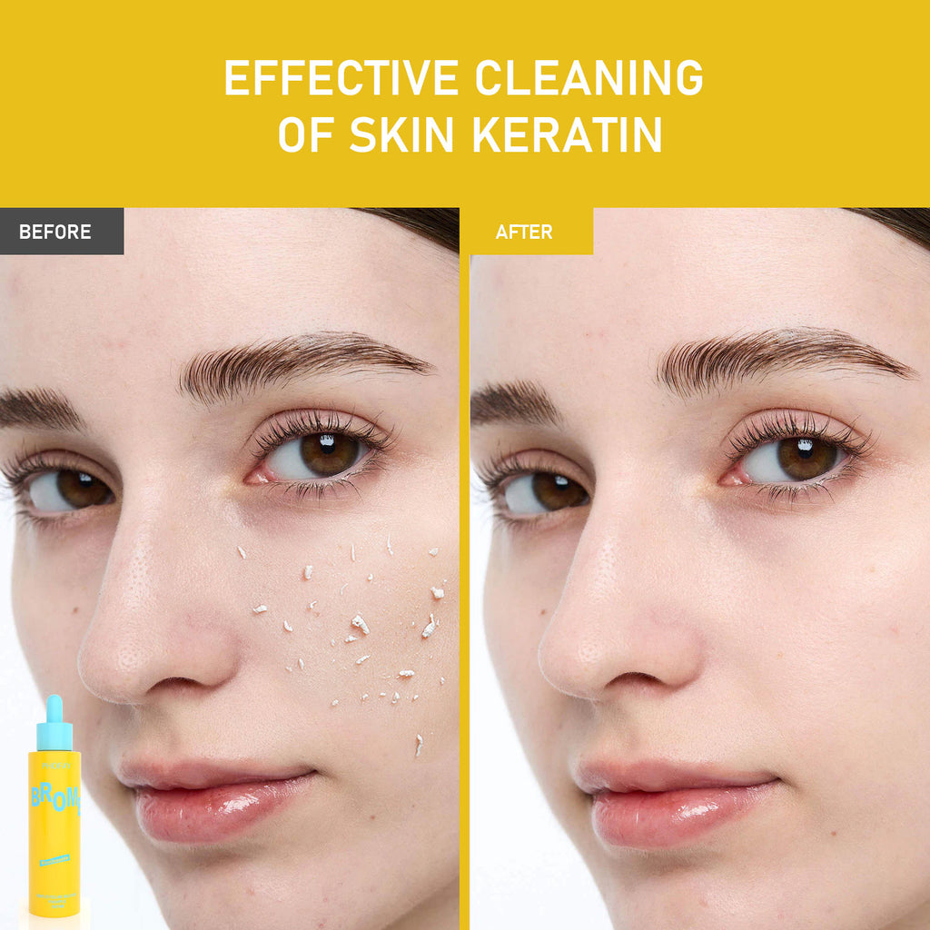 محلول تقشير لطيف من فوفاي، إنزيم البابايا، أحماض ألفا هيدروكسي، أحماض بيتا هيدروكسي