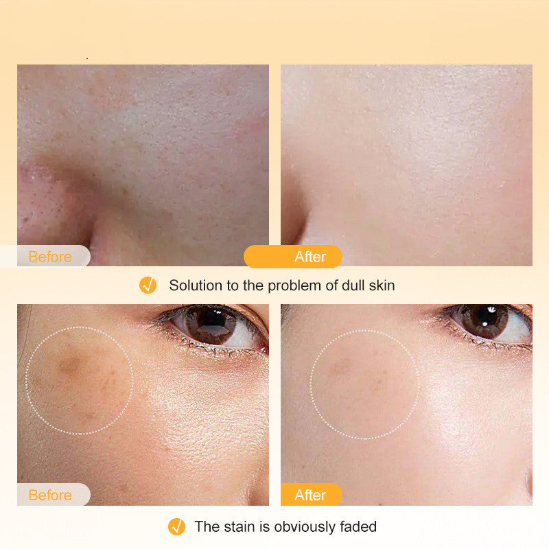 Vitamin C Facial Lotion Skin Care