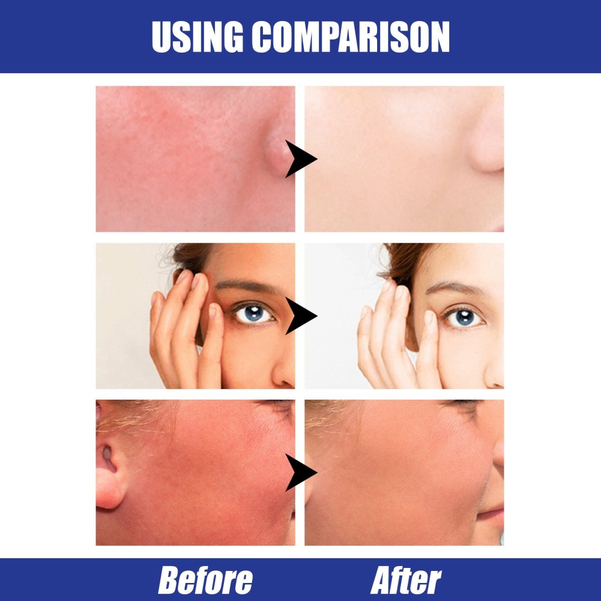 Lightweight Freshing And Moistrurizing Waterproof SPF50 Hyaluronic Acid Sun Block Stick - Eshtree