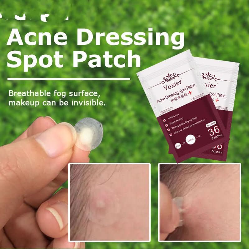 Skin Care Tools Acne Dressing Spot Patch Blemish Treatment Invisible Acne Stickers Pimple Remover Set Face Cream - Eshtree