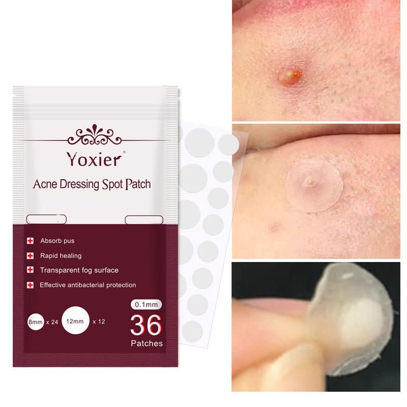 Skin Care Tools Acne Dressing Spot Patch Blemish Treatment Invisible Acne Stickers Pimple Remover Set Face Cream - Eshtree